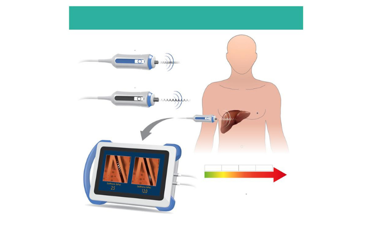 Liver FibroScan