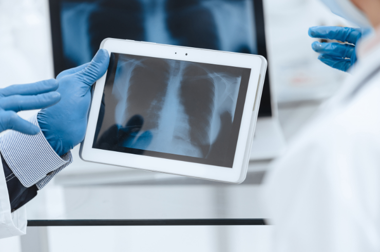 Digital X-Ray