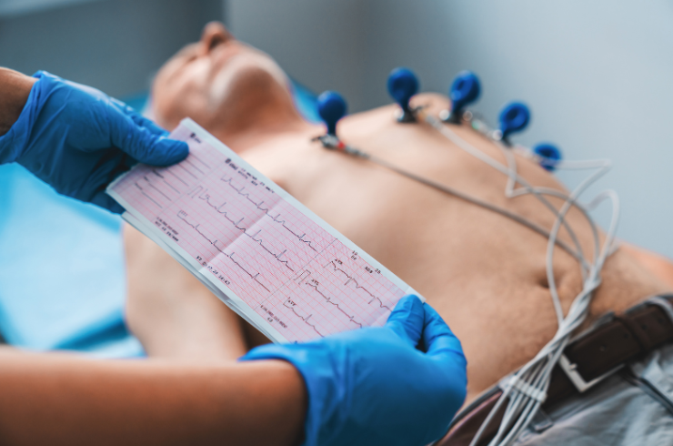 ECG